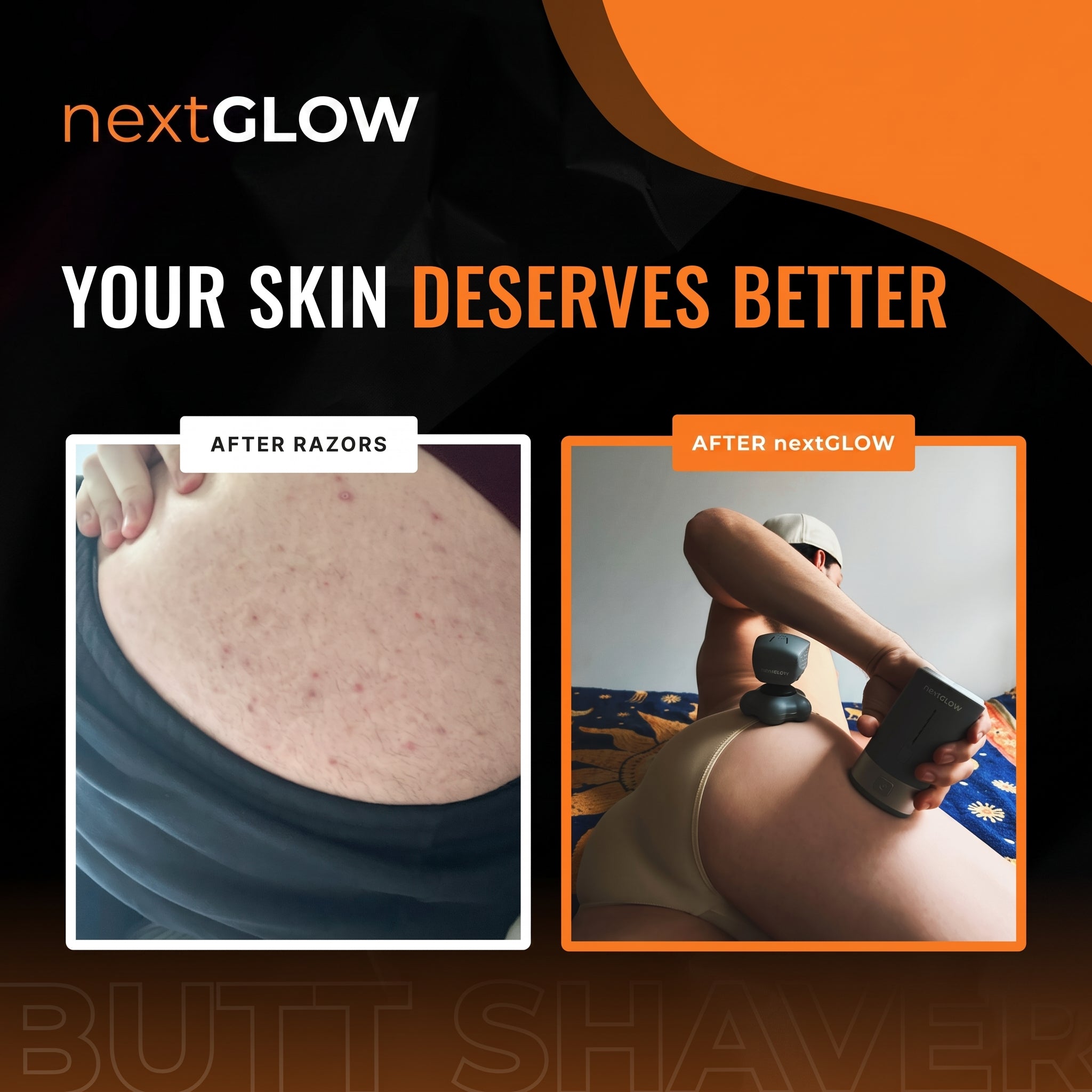 NextGLOW Butt Shaver