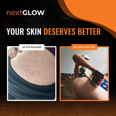 NextGLOW Butt Shaver